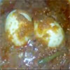 Egg Masala