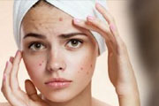 Acne - Modern Therapy.!